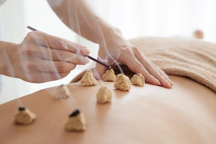 Médecine Traditionnelle Chinoise Moxibustion